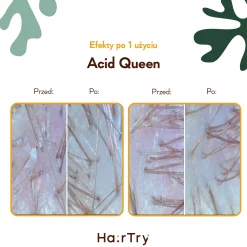 HairTry - Acid Queen - Trychologiczny Peeling Kwasowy do Skóry Głowy - 100ml