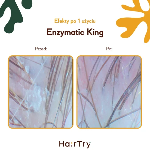 HairTry - Enzymatic King - Trychologiczny Peeling Enzymatyczny z Ficyną - 100ml