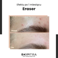 SkinTra - Eraser - Serum na Przebarwienia z Witaminą C 10% - 30ml