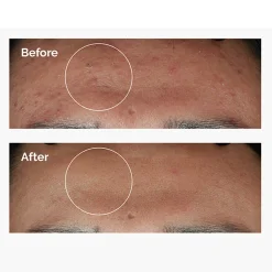 The Ordinary - Niacinamide 10% + Zinc 1%  - Serum z Witaminą B3 i Cynkiem - 30ml